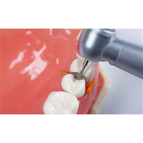 Dental Consumables