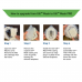 Dental Consumables