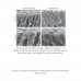 Dental Consumables