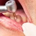 Surgical/Extraction