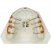 Dental Consumables