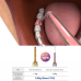 Dental Consumables
